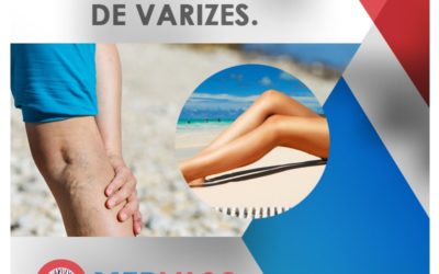 Estética vascular para o verão.